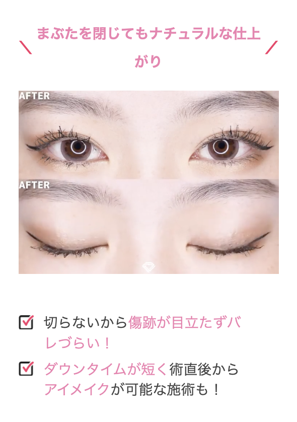 瞼を閉じても