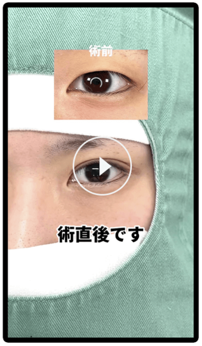 術後です