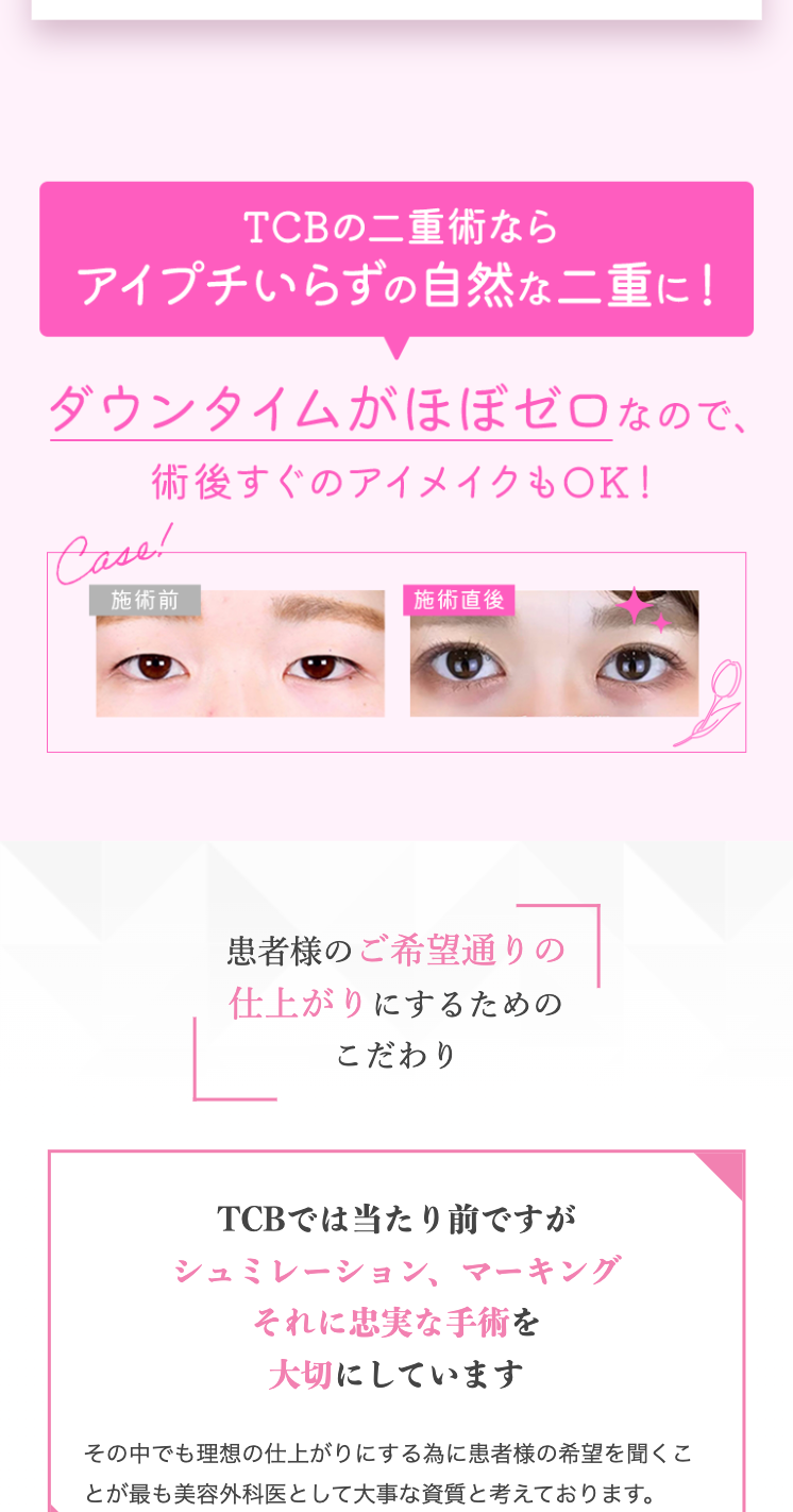 ダウンタイムほぼゼロ